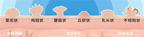 细节说明