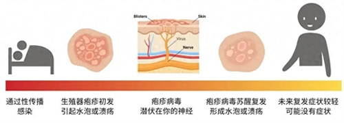 详细说明