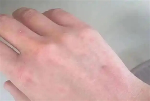 图片细节