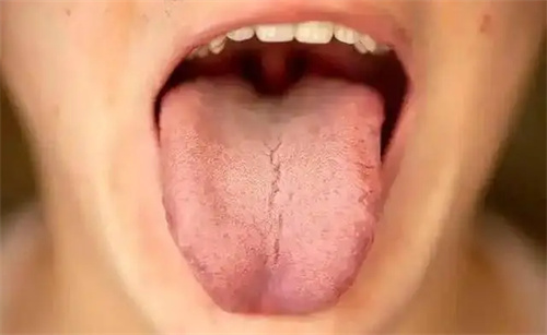 细节介绍