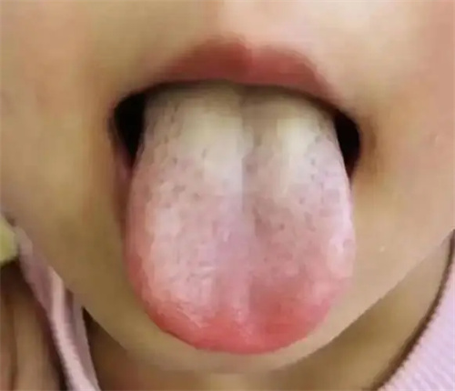 详细说明