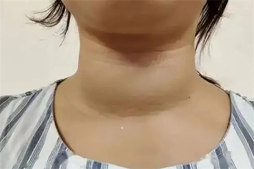 细节介绍
