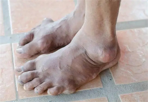 详细说明