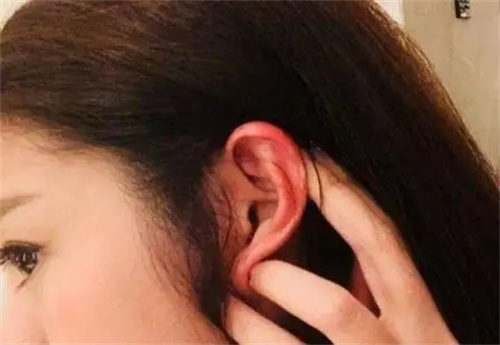 细节说明