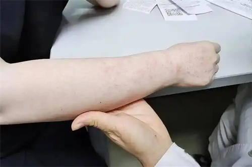 图片细节