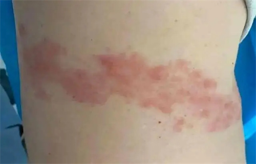 细节介绍