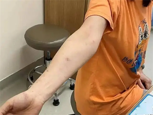 细节介绍