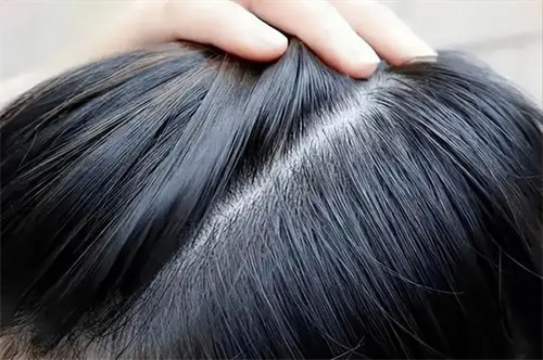 细节介绍